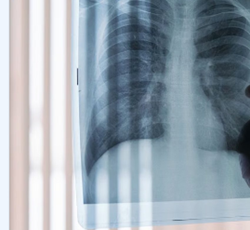 X-Ray